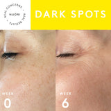 Dark Spots TRIO Set NUORI