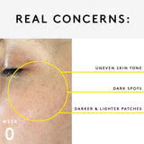 Dark Spots TRIO Set NUORI