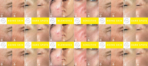Real Concerns, Real Results: Addressing Top Skincare Concerns Naturally