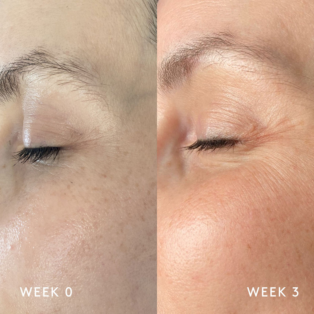 Essential Trio - Dark Spots product NUORI 