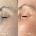 Essential Trio - Dark Spots product NUORI 