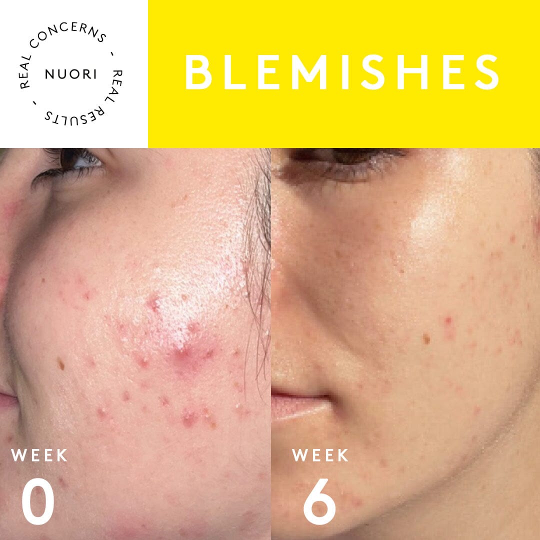 Clarity Mask Skincare Nuori 